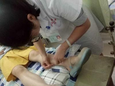 針灸配合治療內科疾病